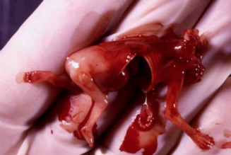 Abtreibung als Menschenrecht: EU-Parlament legalisiert Massenmord an Europäern