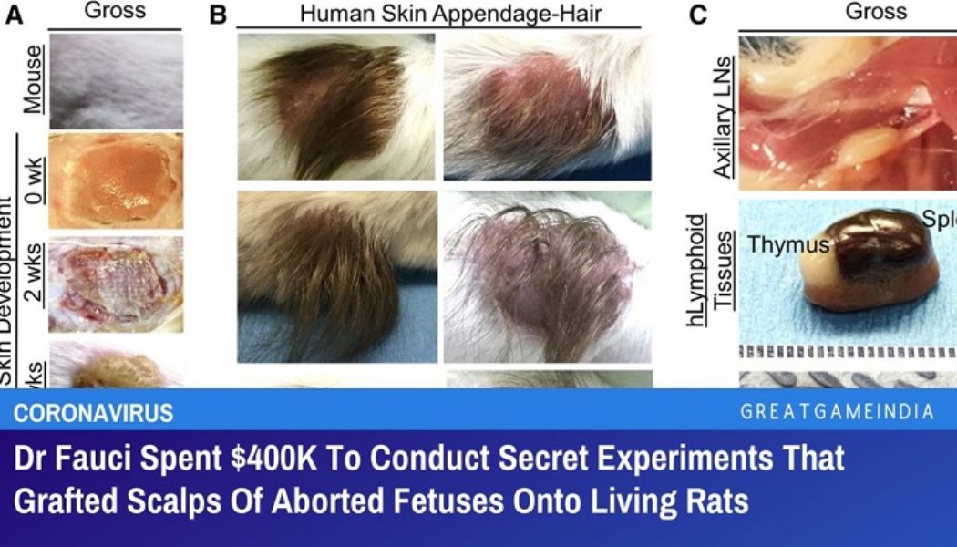 Dr. Fauci Gab 400.000 US-Dollar Aus, Um Geheime Experimente Durchzuführen, Bei Denen Die Kopfhaut Abgetriebener Föten Auf Lebende Ratten Verpflanzt Wurde