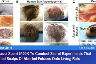 Dr. Fauci Gab 400.000 US-Dollar Aus, Um Geheime Experimente Durchzuführen, Bei Denen Die Kopfhaut Abgetriebener Föten Auf Lebende Ratten Verpflanzt Wurde