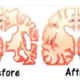 Dr. Newport Kehrte Die Alzheimer-Krankheit Ihres Mannes Mit 4 EL Kokosöl Pro Tag Um