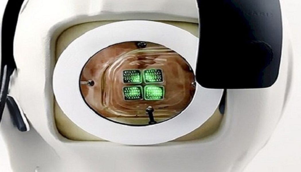 Das weltweit erste menschliche bionische Auge ist bereit und wartet darauf, implantiert zu werden