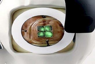 Das weltweit erste menschliche bionische Auge ist bereit und wartet darauf, implantiert zu werden