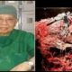 Doktor Gupta sagt: Niemand sollte an Krebs sterben.