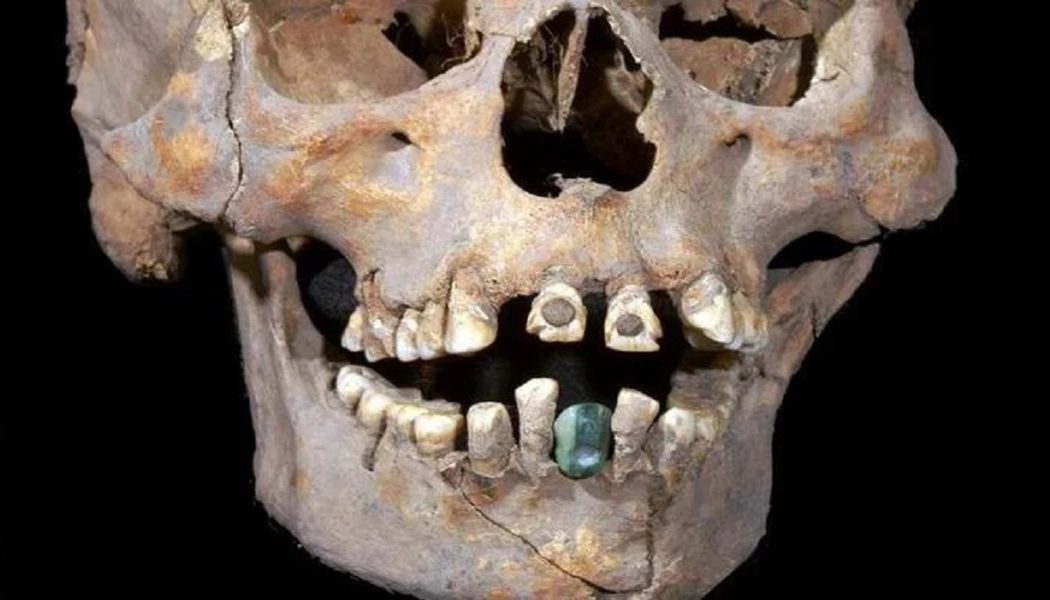 Ein Alter Schädel Mit Zahnersatz, Der In Einer Mexikanischen Pyramide Gefunden Wurde