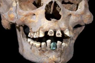 Ein Alter Schädel Mit Zahnersatz, Der In Einer Mexikanischen Pyramide Gefunden Wurde