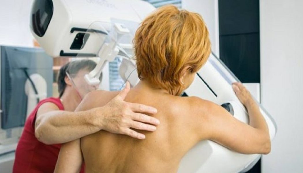Studien ergeben schockierendes: Mamographie begünstig krebs ( Videos und Studien )