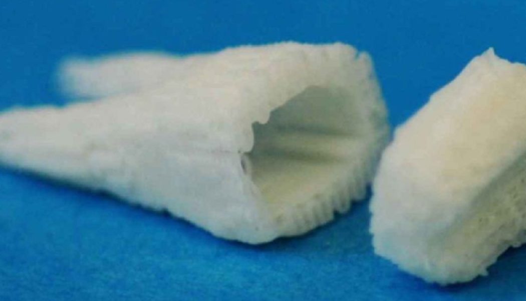 Zahnimplantate mit Stammzellen können in nur 2 Monaten neue Zähne bekommen