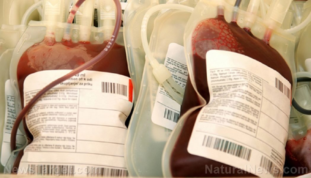 Ungeimpfte Blutbanken? Erfahren Sie mehr über die wachsende Bewegung für saubere Transfusionen