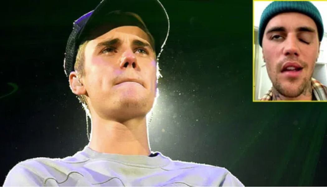 Justin Bieber: Gesichtslähmung ist „Strafe“ für die Aufdeckung der Pädophilie der Illuminaten