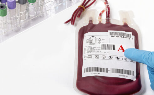 Wissenschaftler empört: Patienten wollen keine Blutspenden von Impflingen